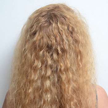 Before | <strong>After</strong>