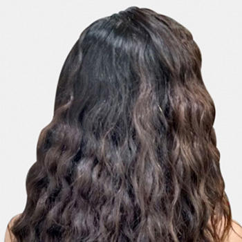 Before | <strong>After</strong>